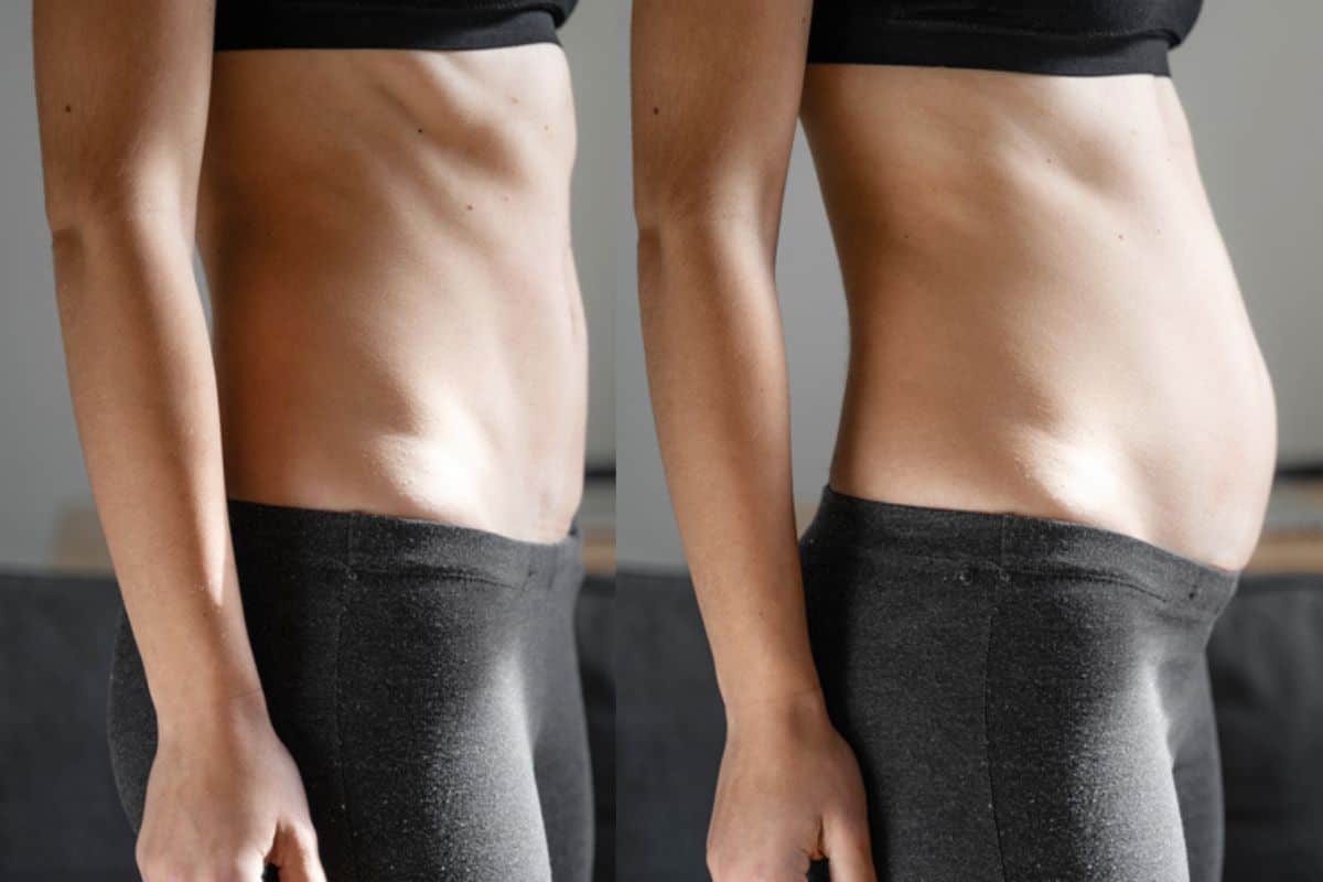 How long does diastasis recti take to improve Tulse Hill?
