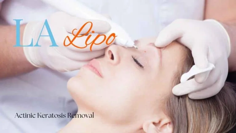 Woman receiving Actinic Keratosis Removal Treatment Tulse Hill