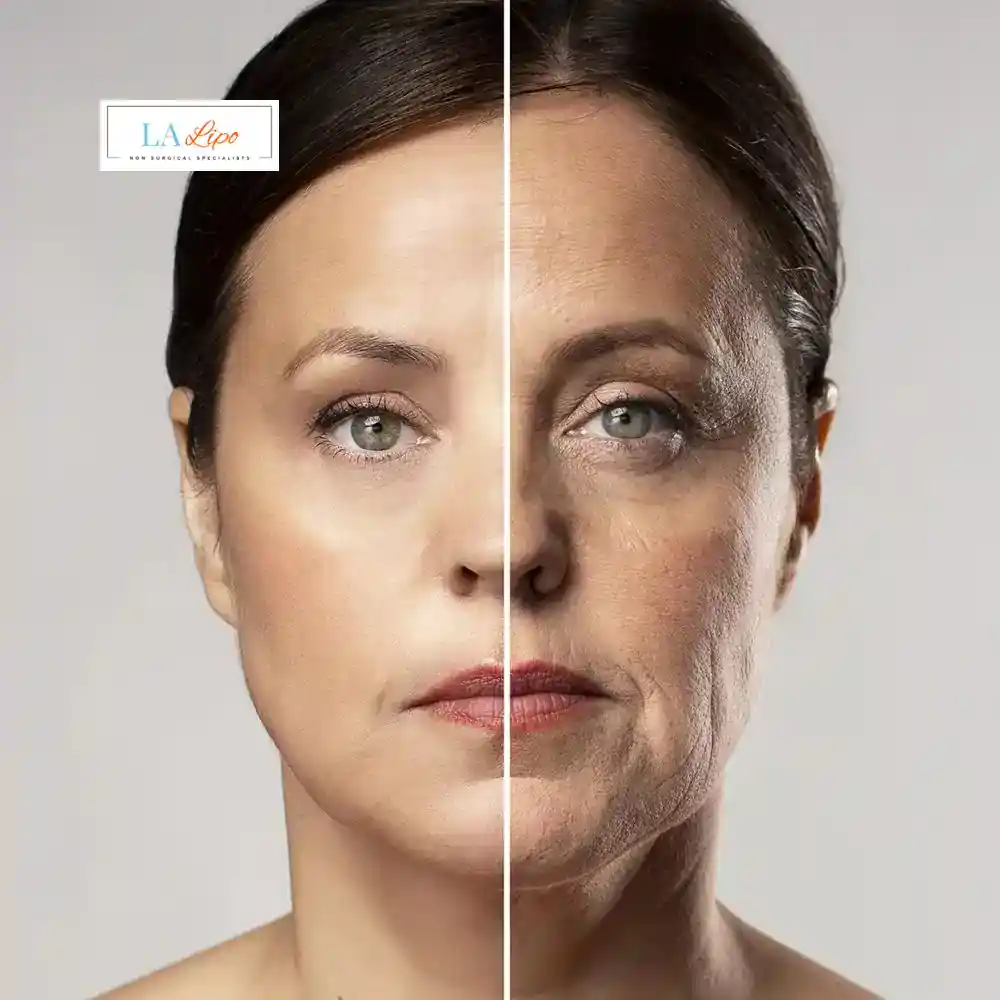How Can You Tell If Non-Surgical Skin Tightening Is Right for You Tulse Hill?