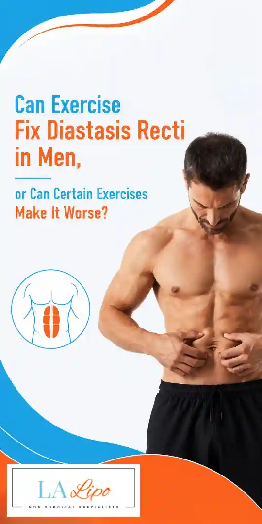 Can Exercise Fix Diastasis Recti in Men, or Can Certain Exercises Make It Worse Tulse Hill?