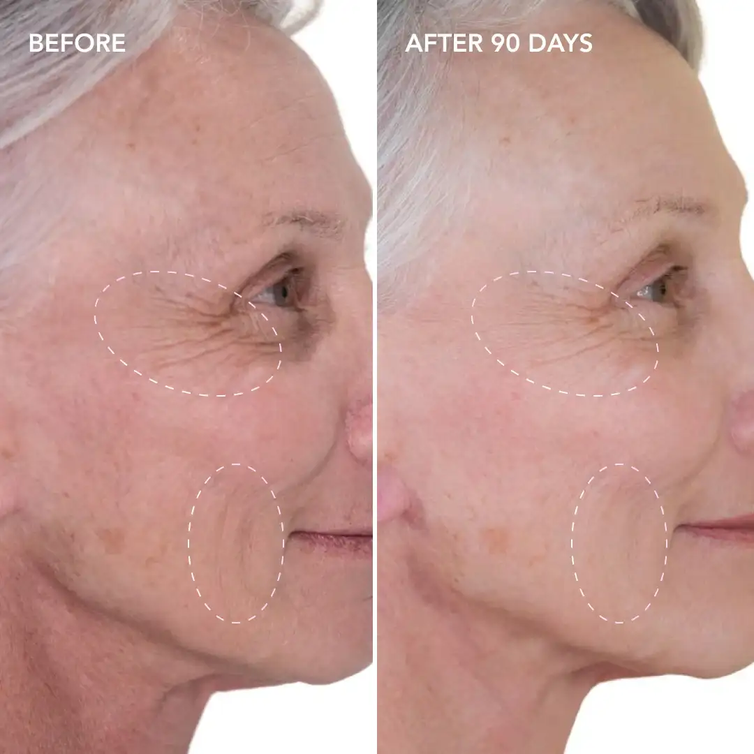 When will you see results Tulse Hill